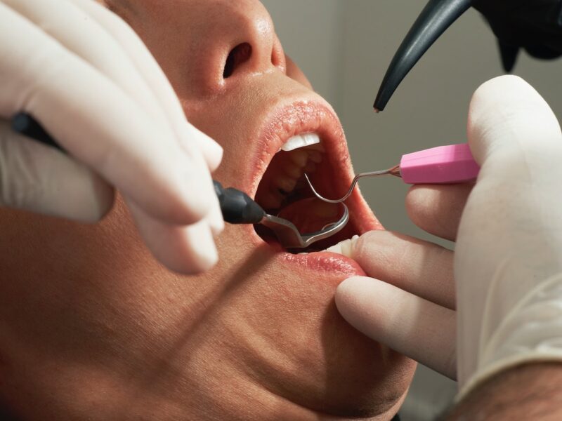 Person having dental work done