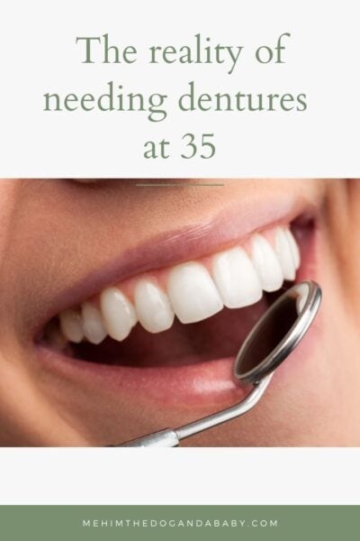 The reality of needing dentures at 35